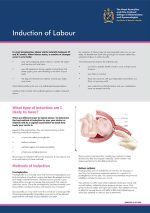 Induction labour pamphlet-1