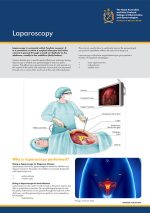 laparoscopy-1